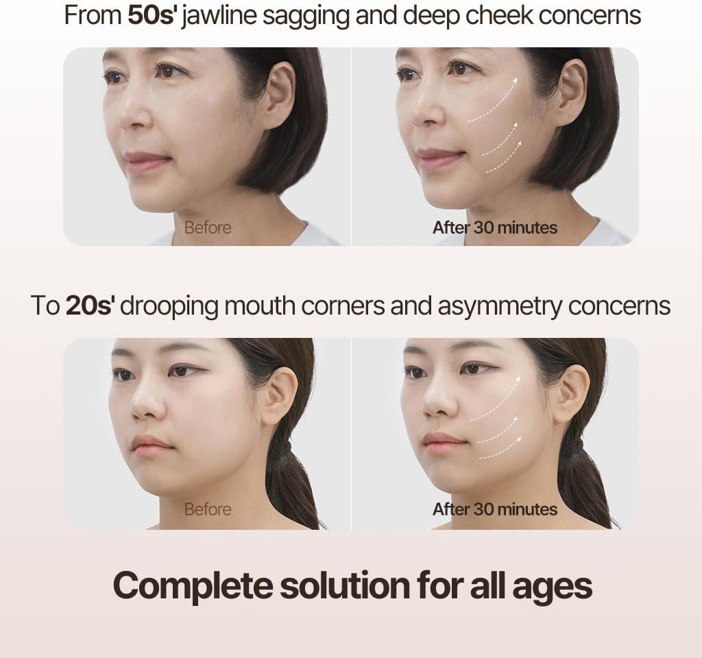 MARSHIQUE Line Lifting Hydrogel Mouth Corner Patches