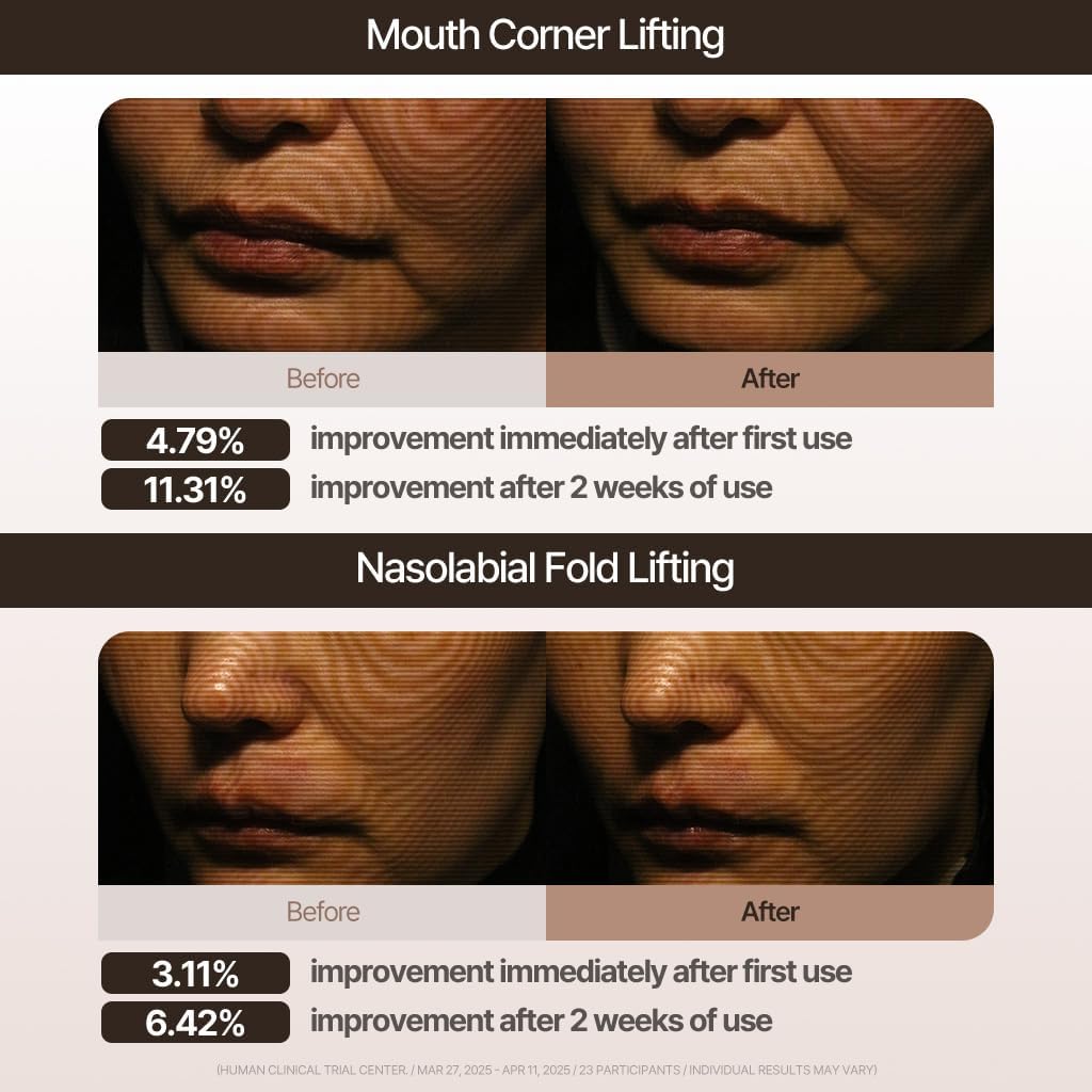 MARSHIQUE Line Lifting Hydrogel Mouth Corner Patches