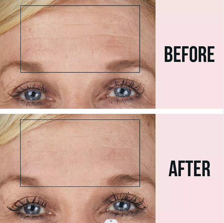 BEAUTY REVIVE Micro-needle Soluble Forehead Patches