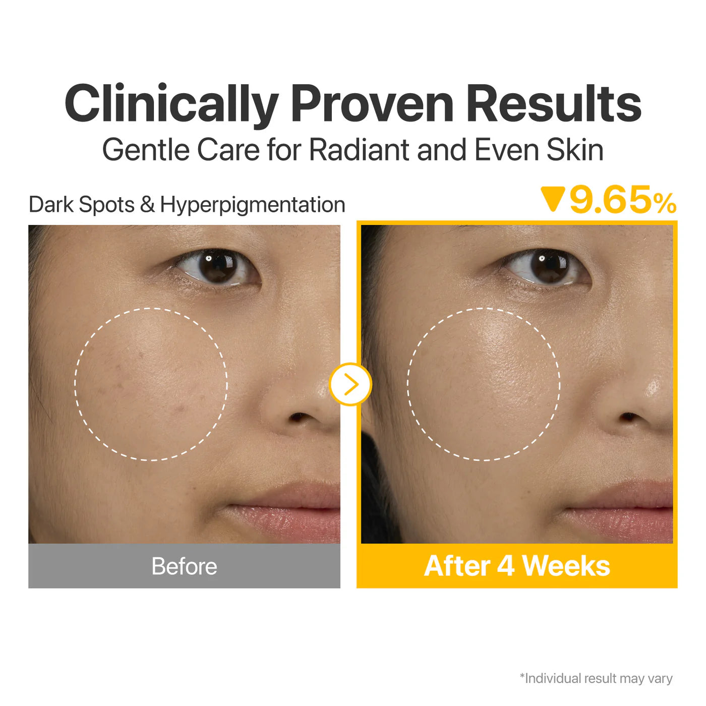 Numbuzin No.5+ Glutathione Vitamin Concentrated Serum | Brightening Glow Serum