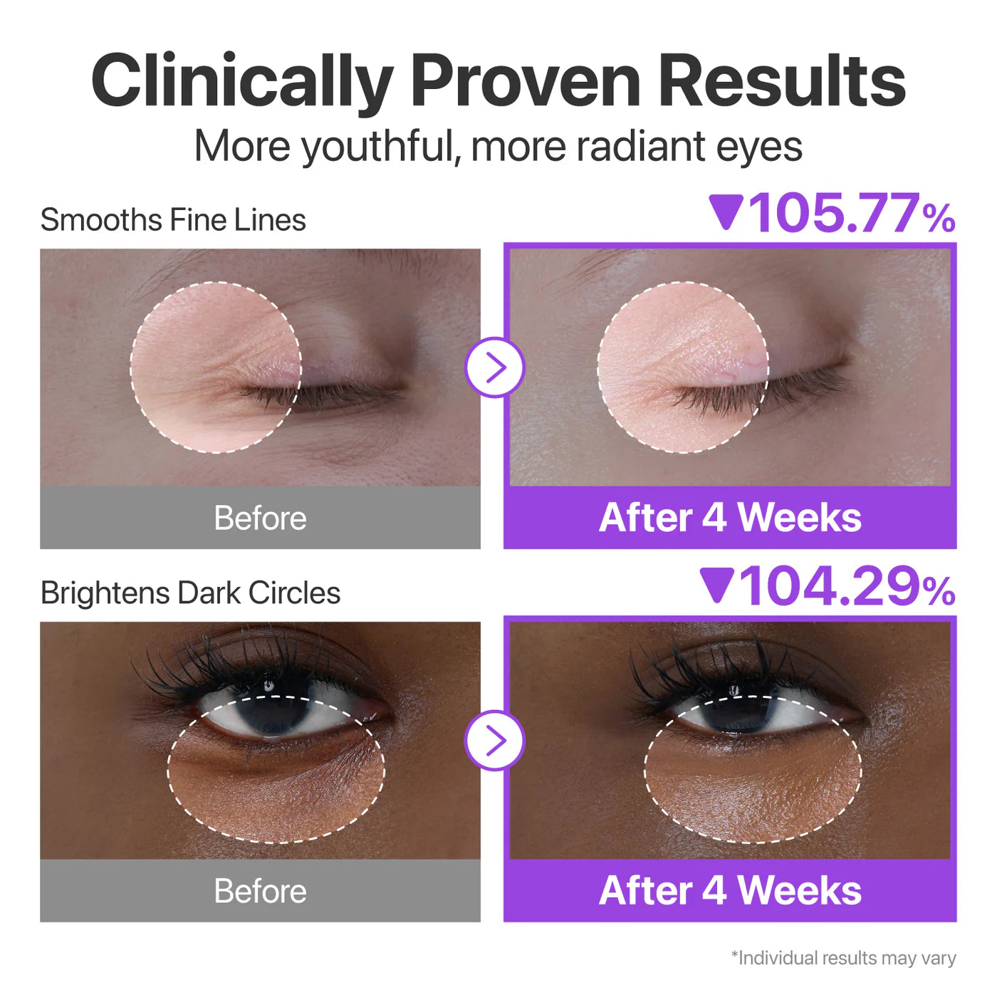 Numbuzin No.9 NAD+ Retinol Volumetox Eye Cream 10ml | Anti-Ageing Eye Treatment