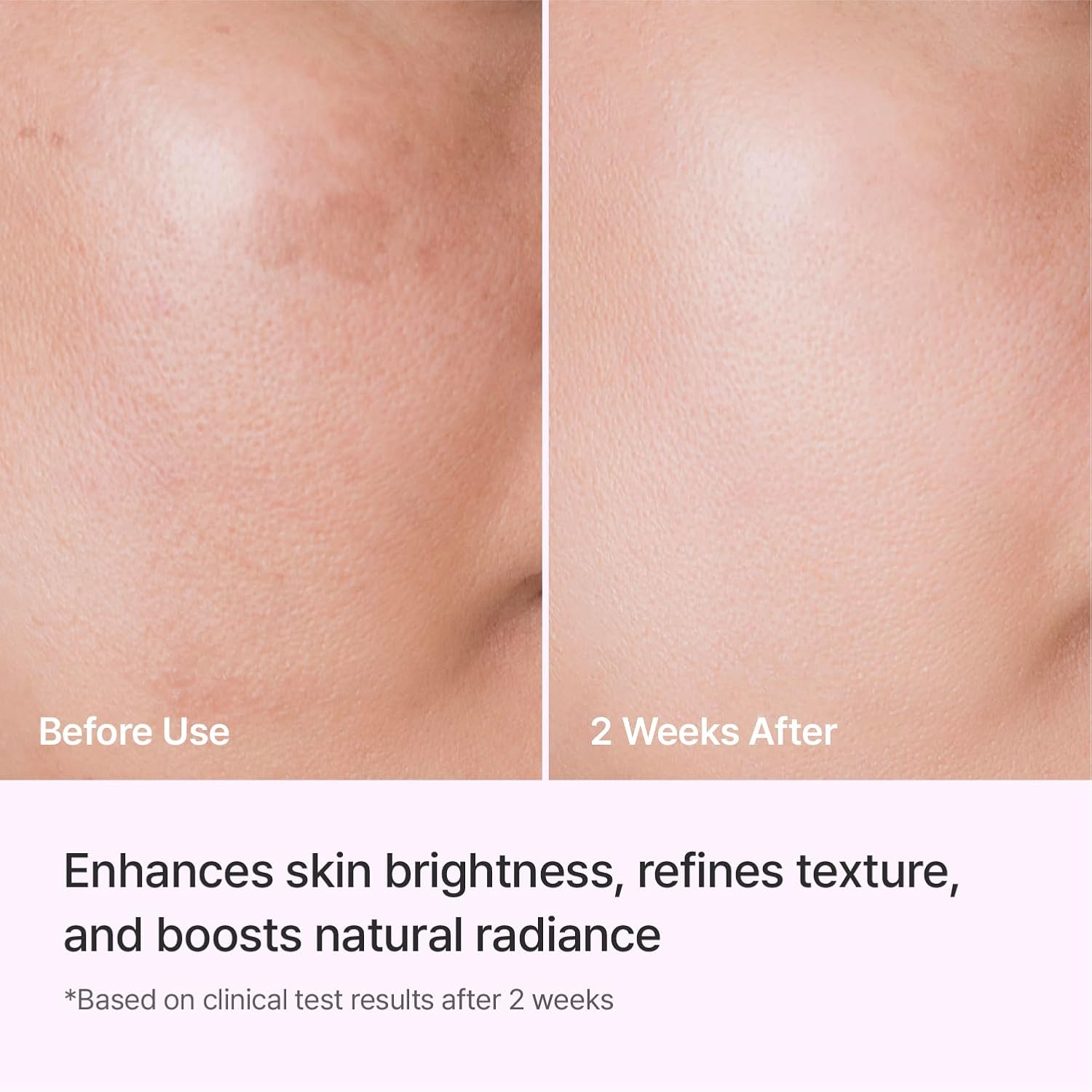 REJURAN Triple Radiance Ampoule 50ml