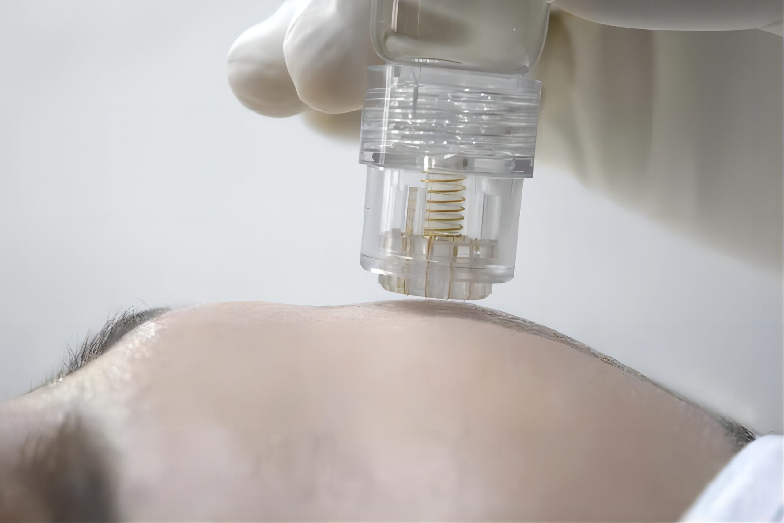 BEAUTY REVIVE 5D Micro-Infusion TRY ME Set